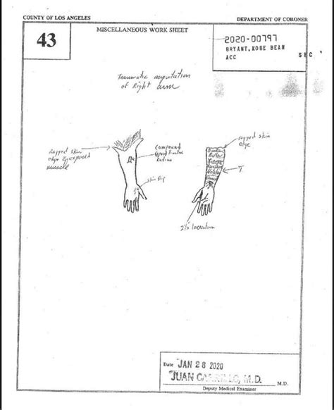 kobe and gigi autopsy|File : Kobe Bryants autopsy report, 2020.pdf